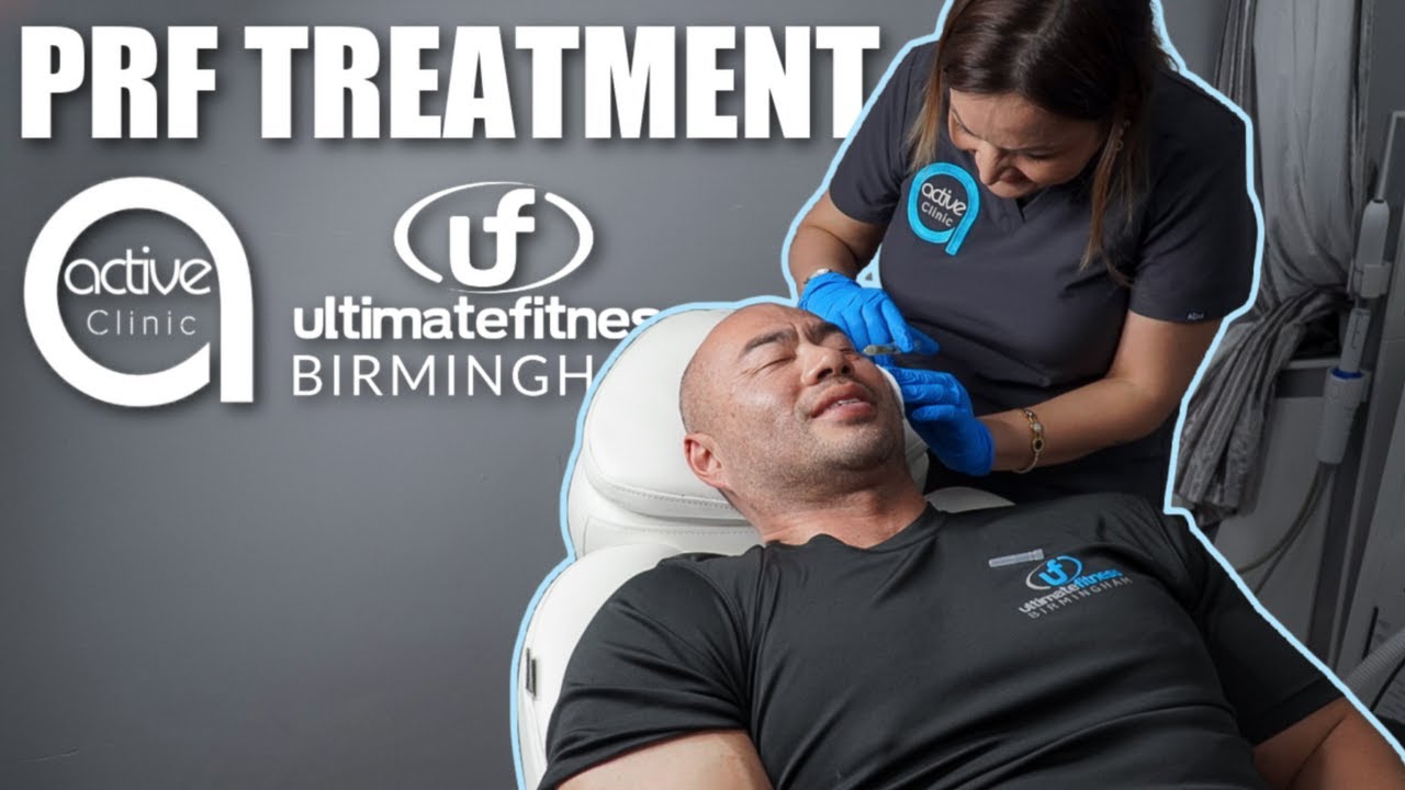 Platelet Rich Fibrin (PRF) Treatment For Face  | PRF Before After | Anti-Aging | Active Clinics