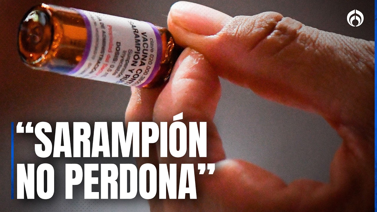 ¿Sarampión está fuera de control? Esto responde el doctor Alejandro Macías