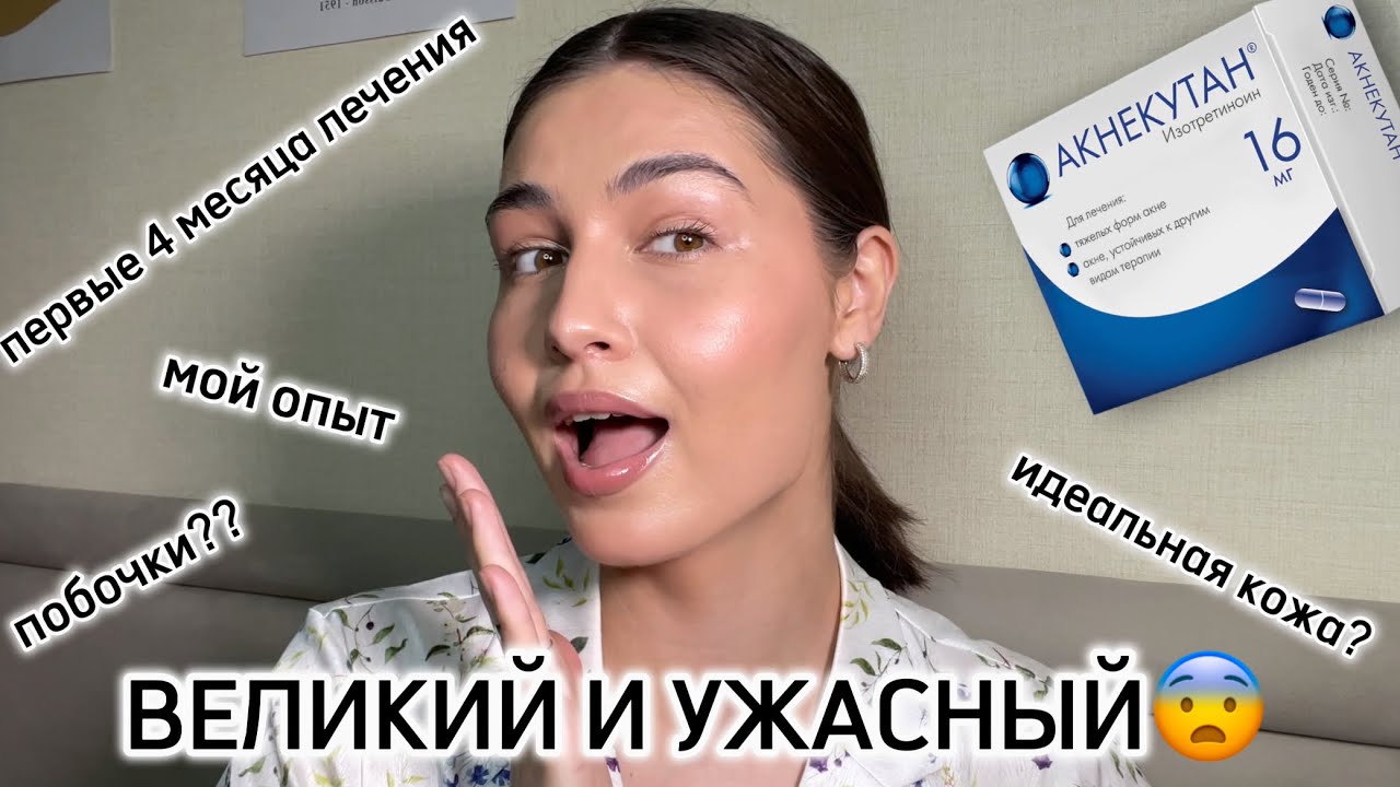 АКНЕКУТАН | первые 3 месяца знакомства с системными ретиноидами 🥴