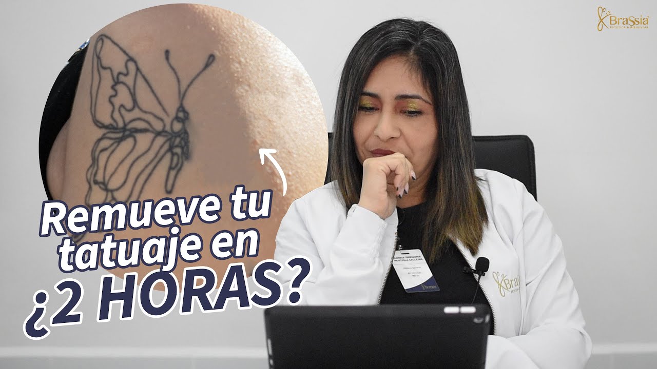 ELIMINA tu tatuaje en ¿2 HORAS? 😱🤦🏻‍♀️