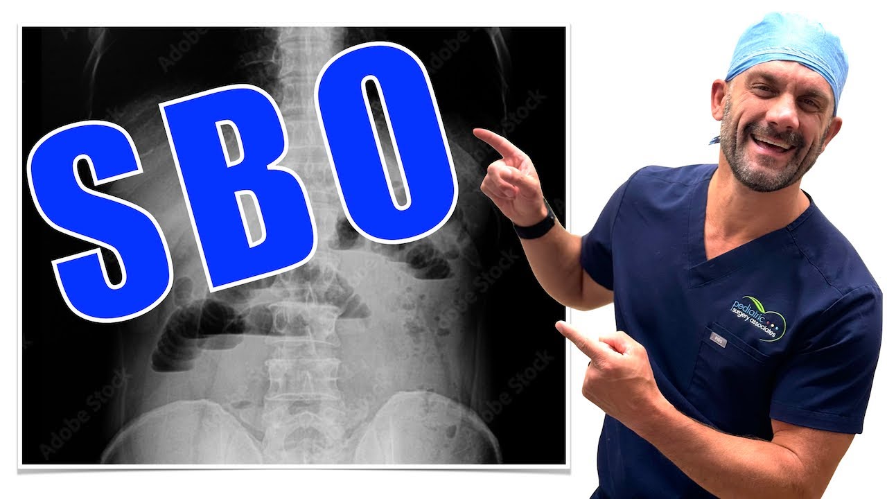 How I Diagnose Bowel Obstruction!