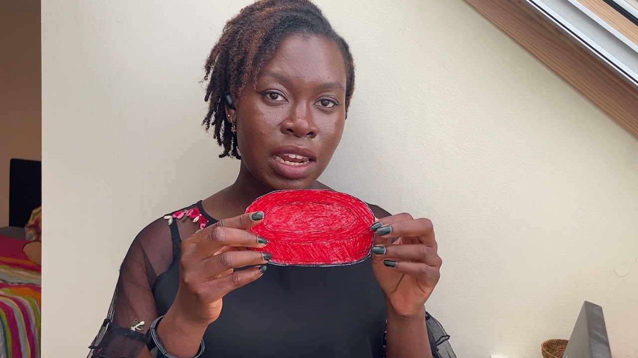 Malaria and sickle cell anaemia - till death do us part | Ifeolutembi Fashina
