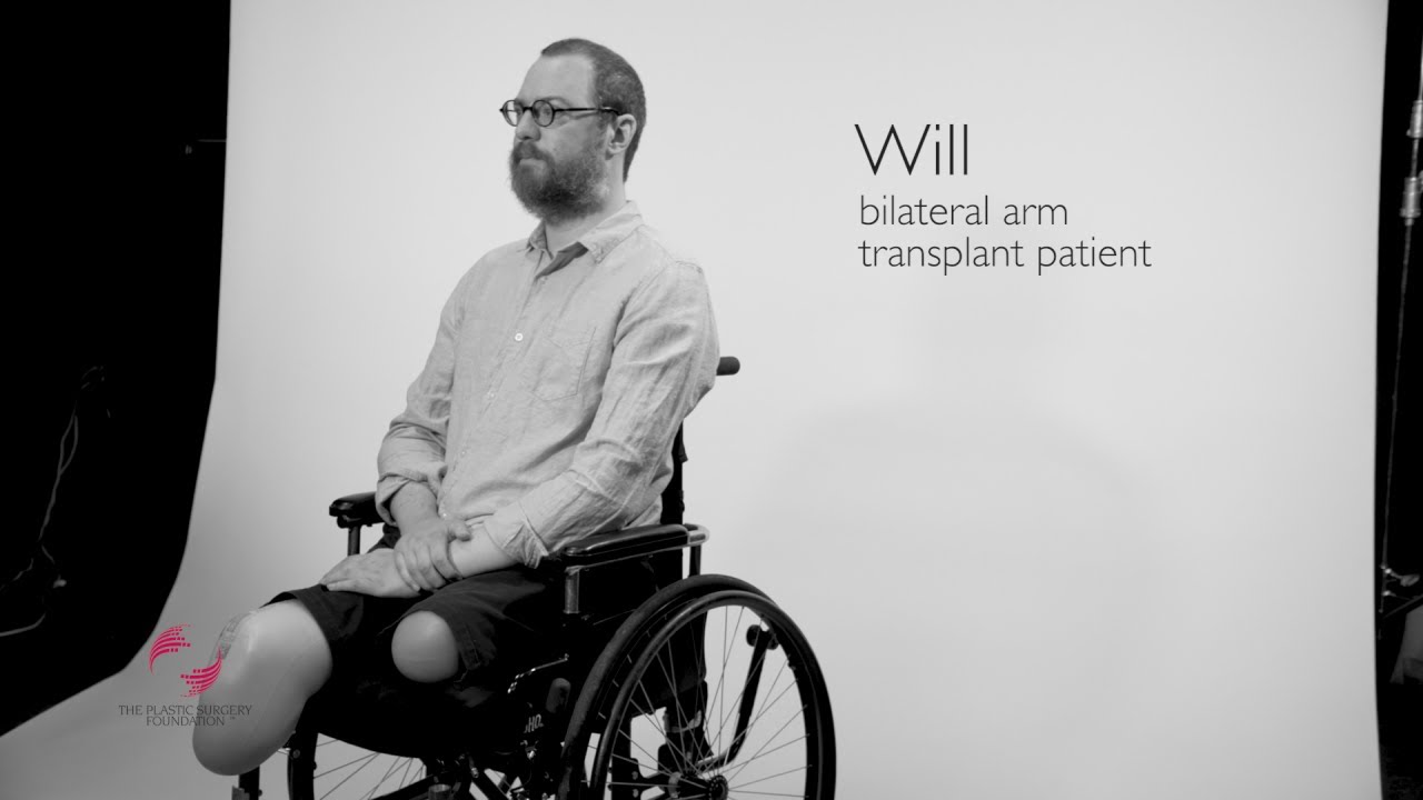 Resilience &ndash; Bilateral Arm Transplant Story