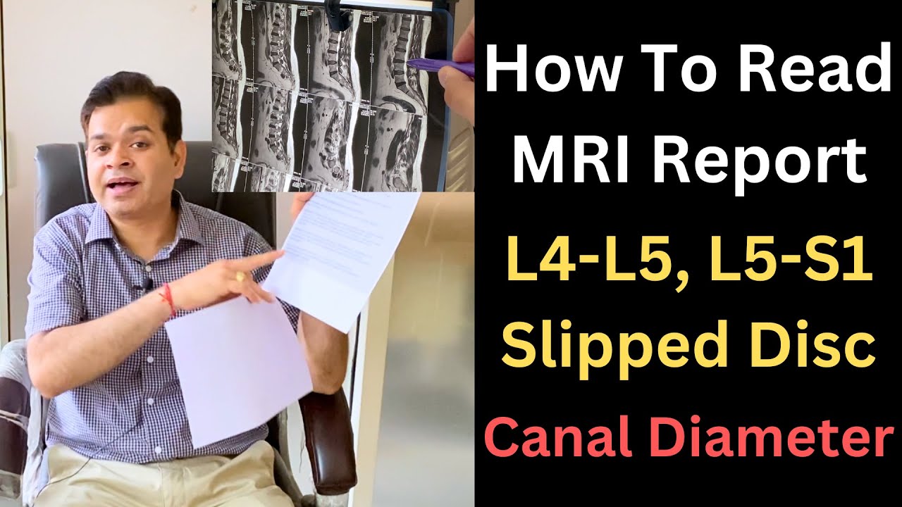 Lower Back MRI, L4 L5 Herniated Disc MRI, Stenosis of the Spine, How to know Lumbar canal Diameter?
