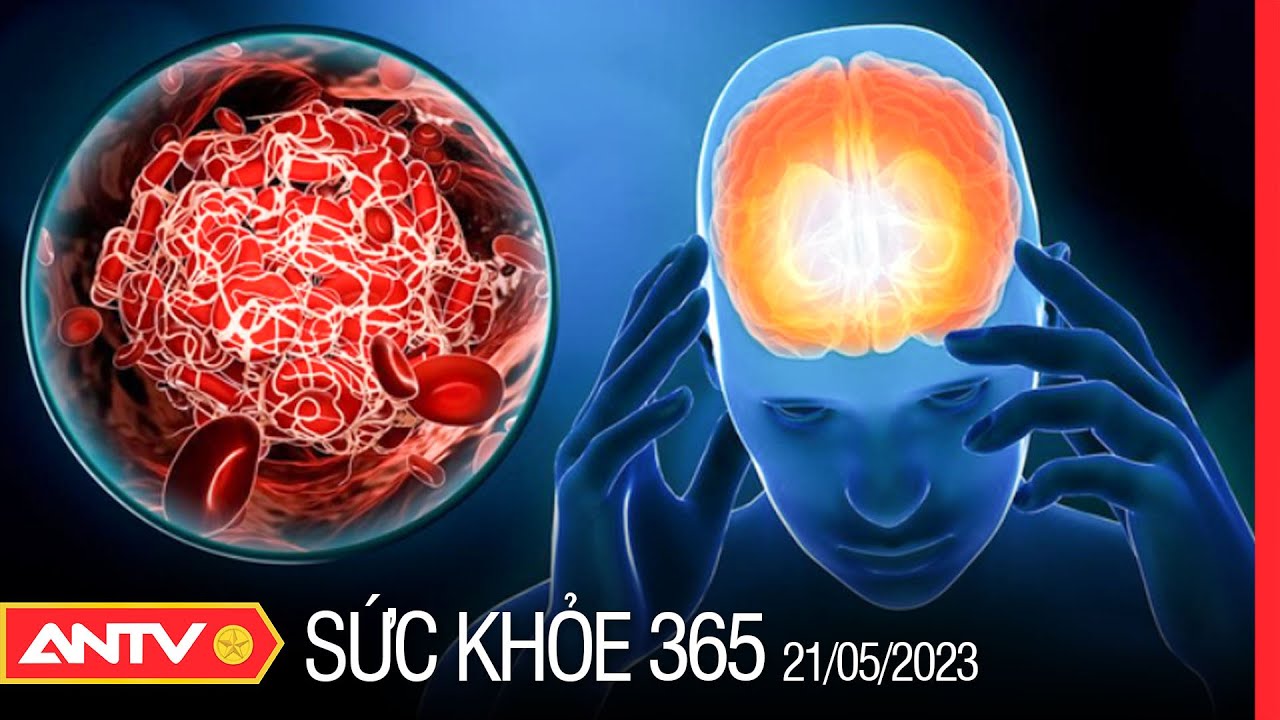 Làm thế nào để phòng ngừa bệnh đột quỵ? | Sức khỏe 365 | ANTV
