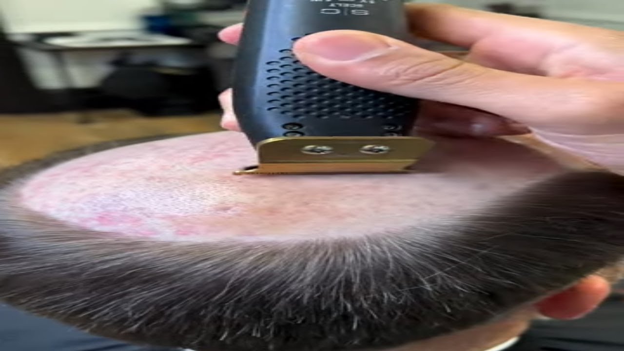 Golden Hair Systems | Flawless Transformation | Lavivid Hair System