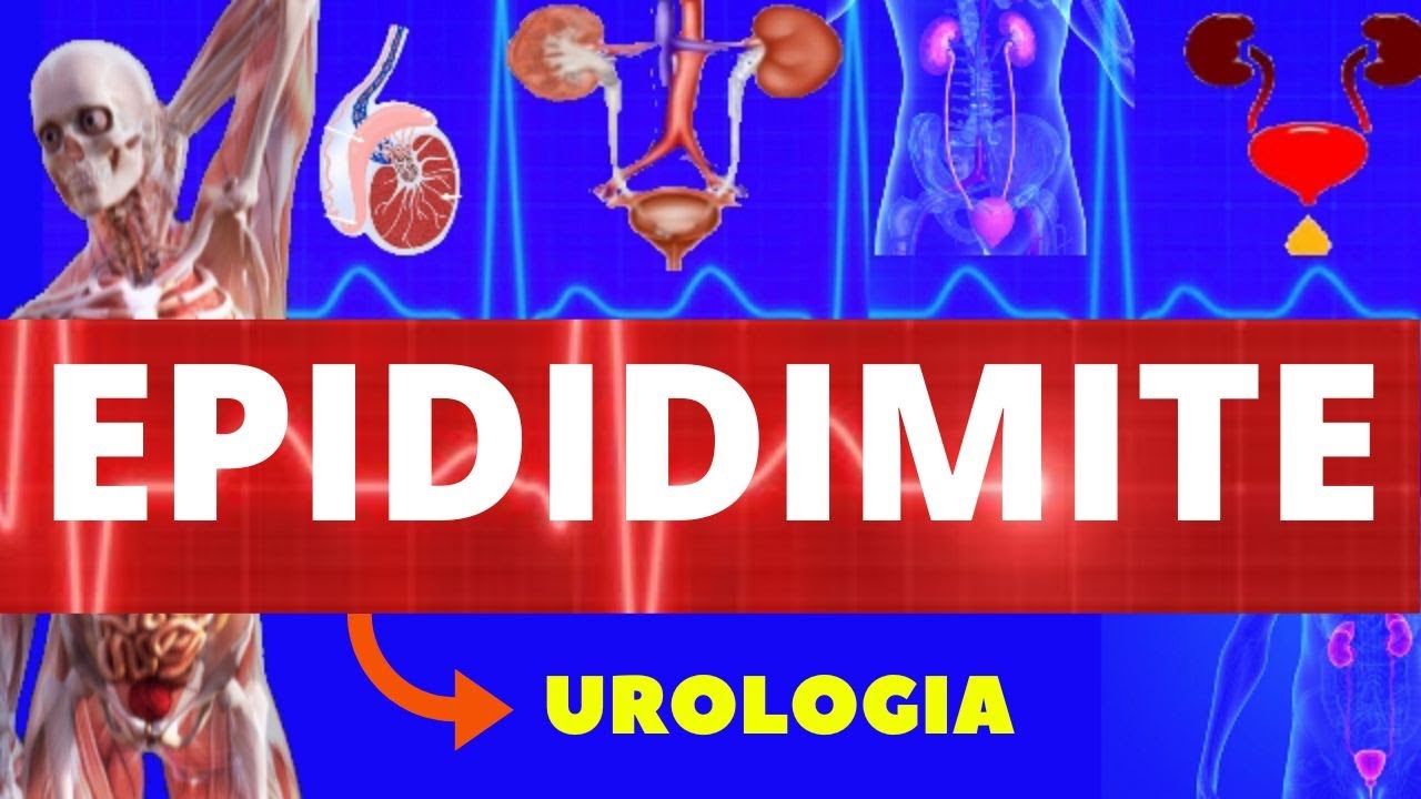 EPIDIDIMITE - CAUSAS, SINTOMAS, DIAGNÓSTICO E TRATAMENTO - UROLOGIA