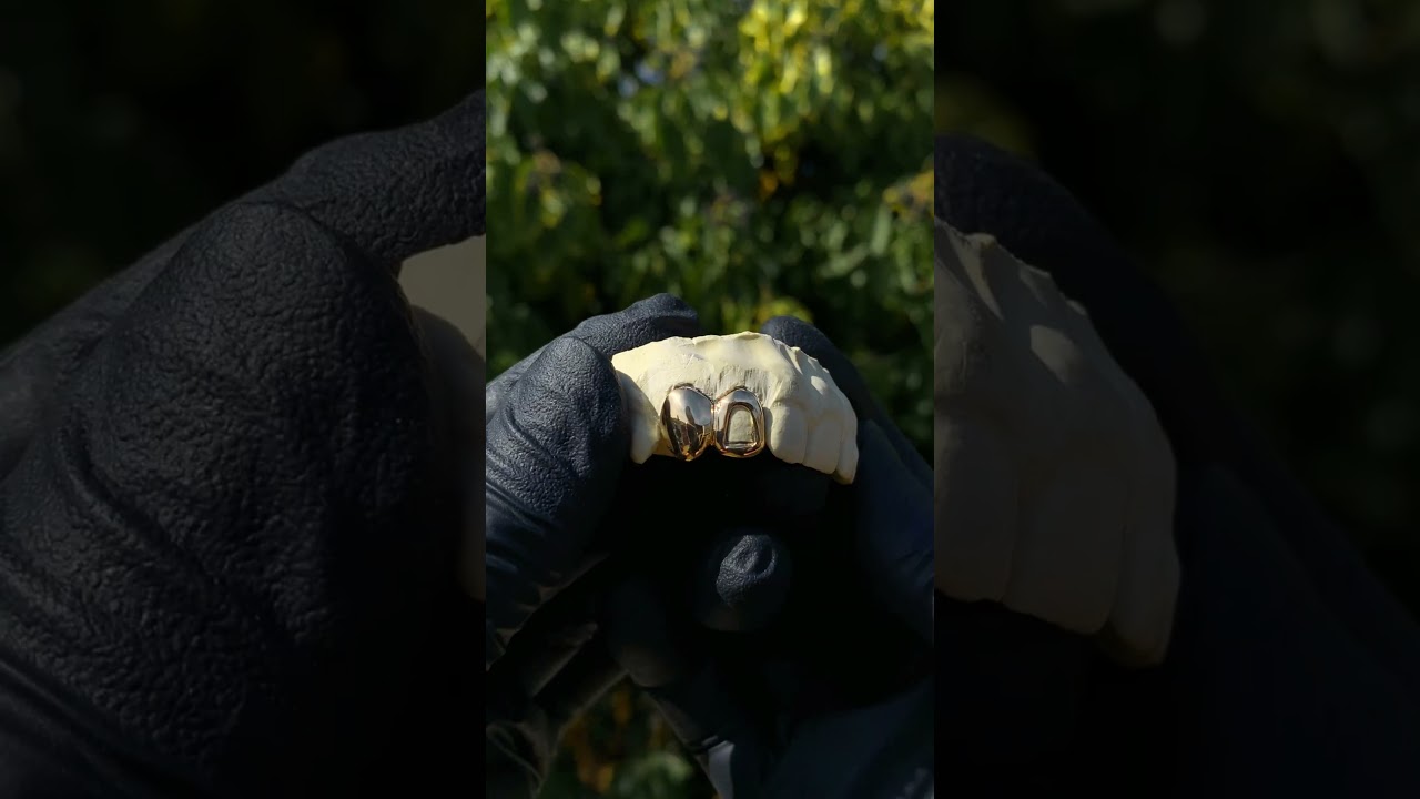 Gold Grillz by 