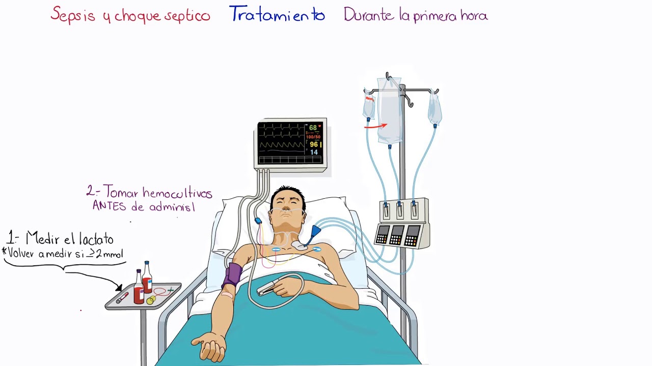 Sepsis y choque septico / Ultimas recomendaciones y to lo que debes saber para el #ENARM