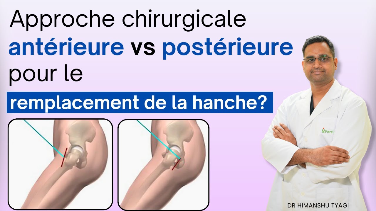 Approche chirurgicale antérieure vs postérieure pour le remplacement de la hanche ? Hip replacement 