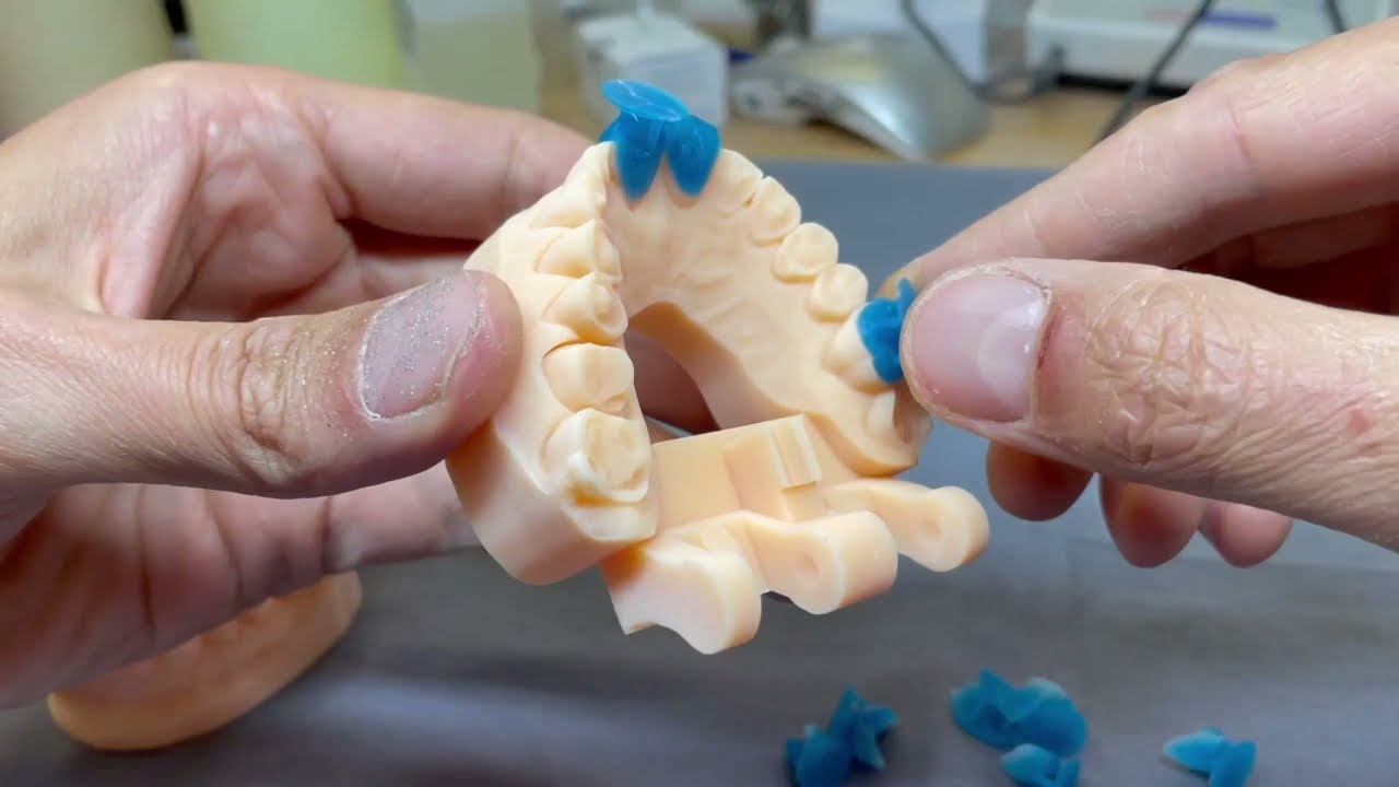 DSD - Digital Smile Design real case