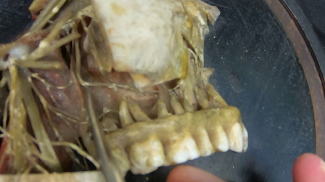 Cranial Nerve Review   CNV