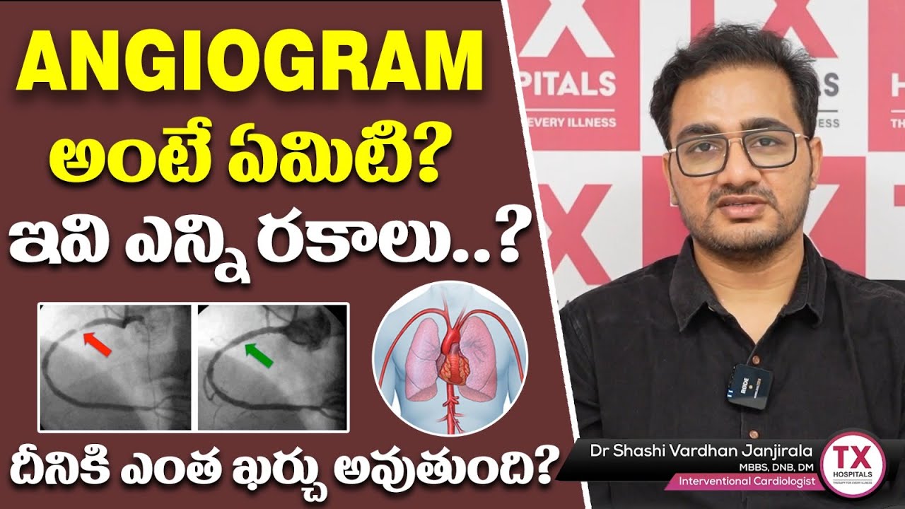 Angiogram అంటే? | What is Angiogram? | Angiogram Cost in Hyderabad | Dr Sasi Vardhan | TX Hospitals