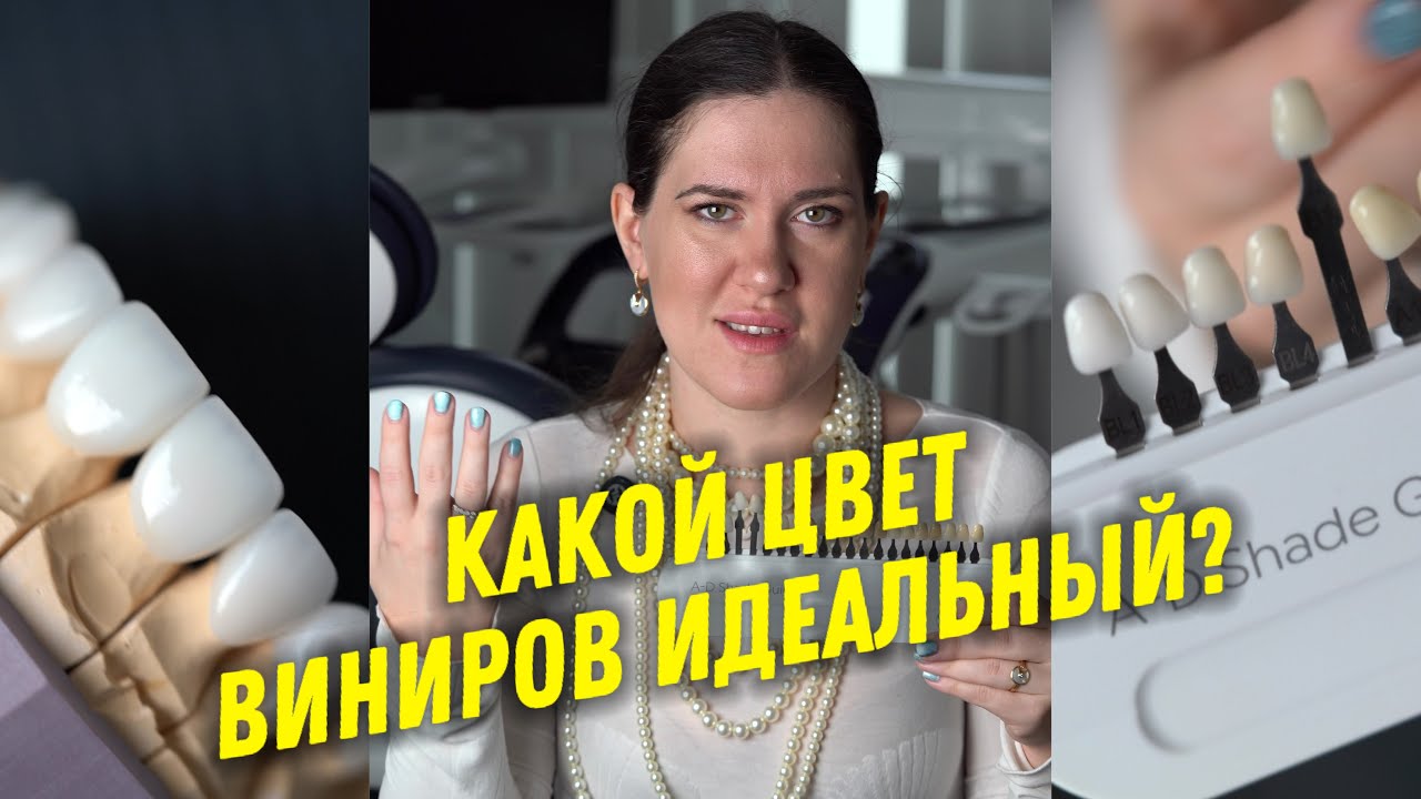 Как выбрать цвет виниров? Какой цвет виниров лучший? Тонкости цветов Блич 1, Блич 2, Блич 3, Блич 4