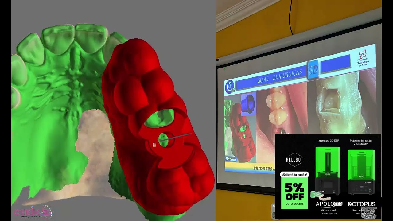 CERIK3D - video 1-  VIVO Curso Guía Quirúrgicas 3D en Blue Sky Bio Plan- Tutorial- AREA3D COS 2023