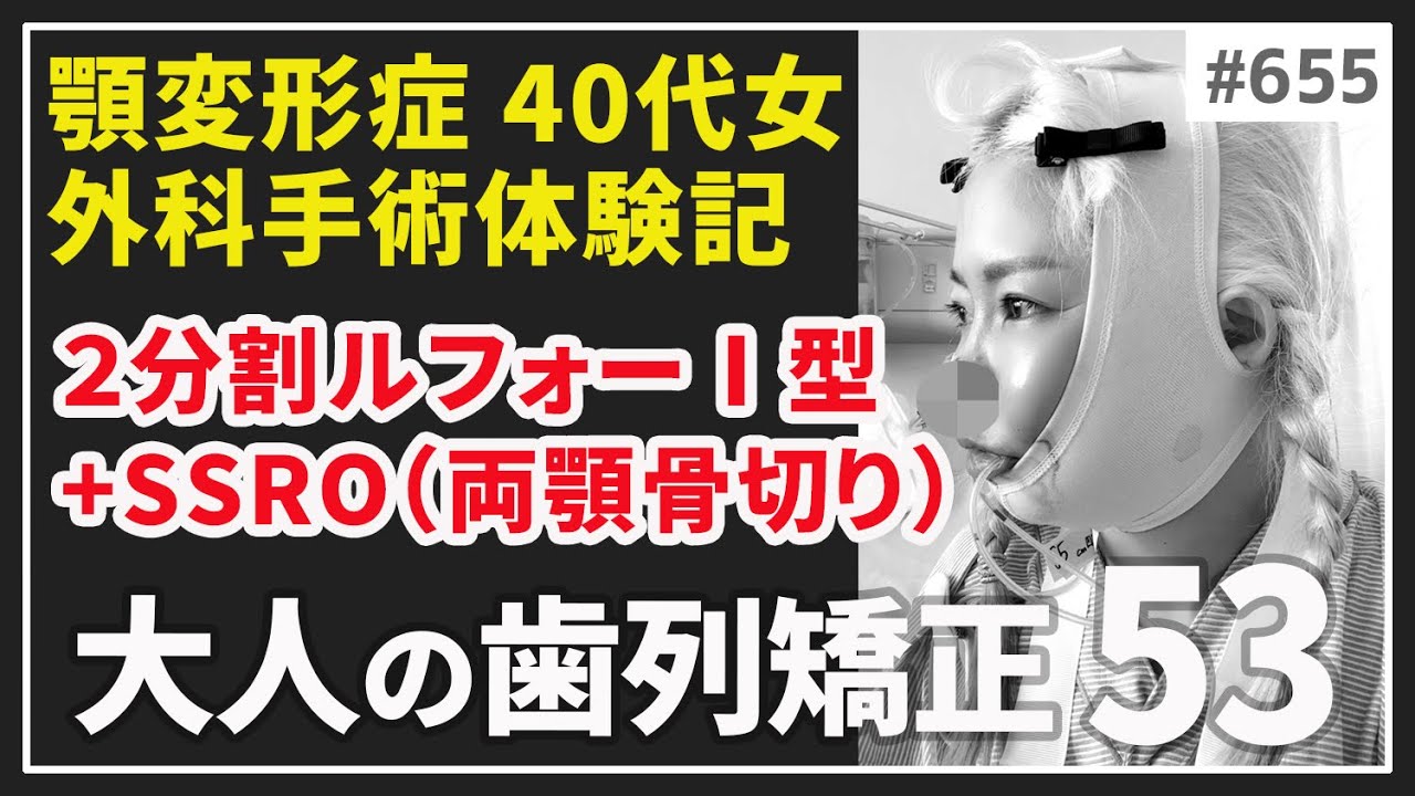 【655】大人の歯列矯正53🦷入院・手術・退院15日間の記録～顎変形症・下顎前突・上顎後退