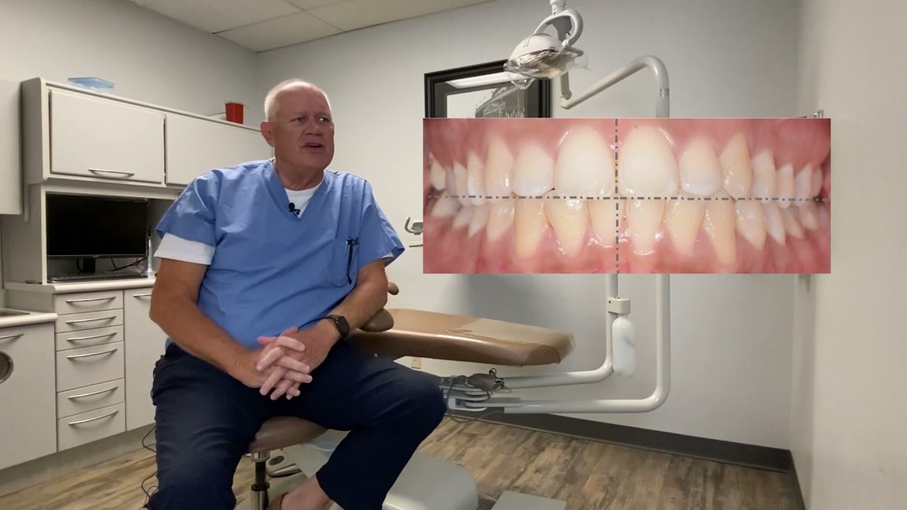The Lower Jaw as a Lever System - RU Physics of Medicine