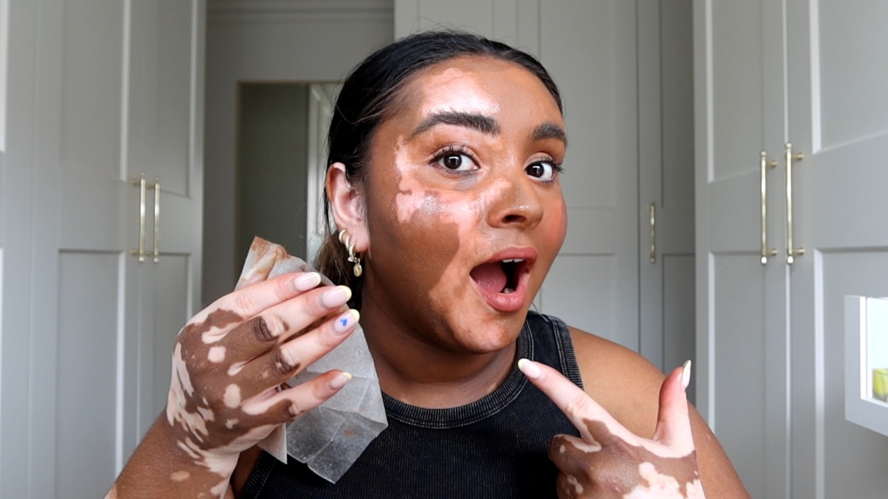 ATTEMPTING TO COVER MY VITILIGO... AGAIN