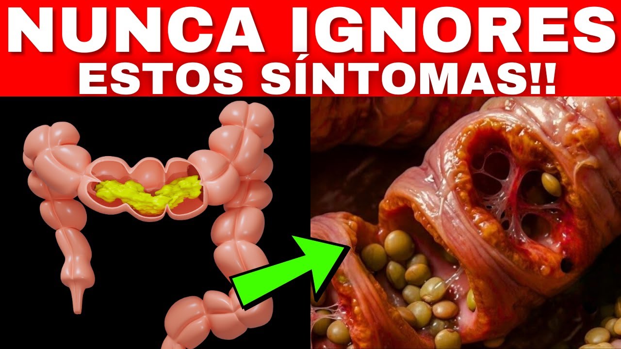 CANCER DE COLON: GRAVES SEÑALES que NUNCA Debes Ignorar