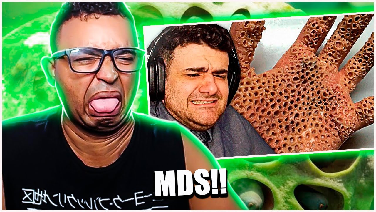 REACT | Fobias Assustadoras Parte 2 (Tente Não Sentir NOJO) - HUEstation