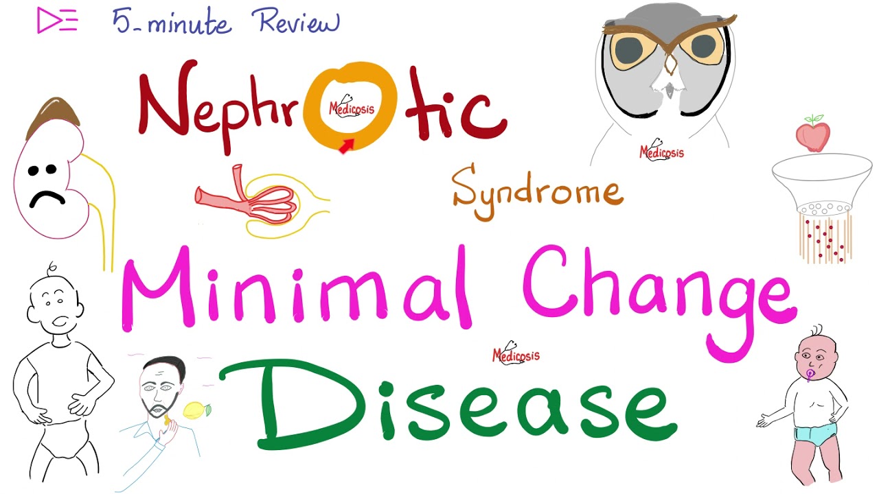 Minimal Change Disease | Nephrotic Syndrome | 🖐 5-Minute Review
