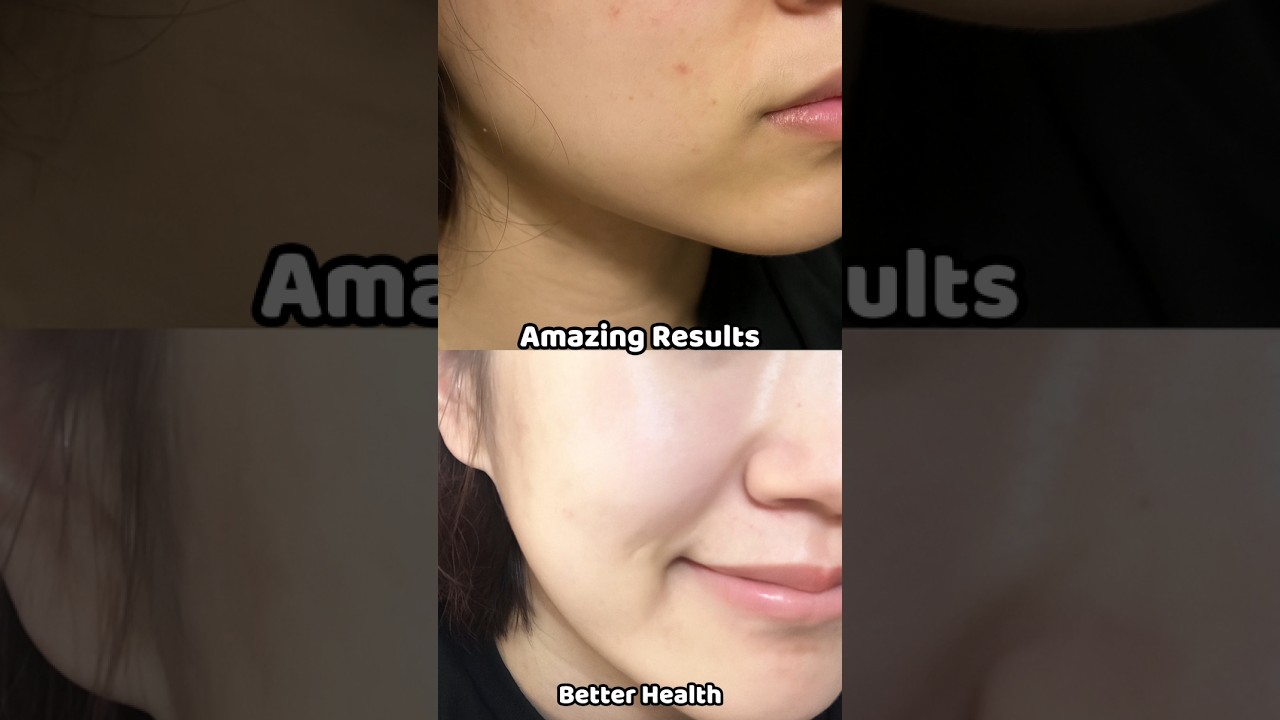 How to Get Clear and Glowing Skin Fast Naturally at Home 🌸 | Clear Skin Tips