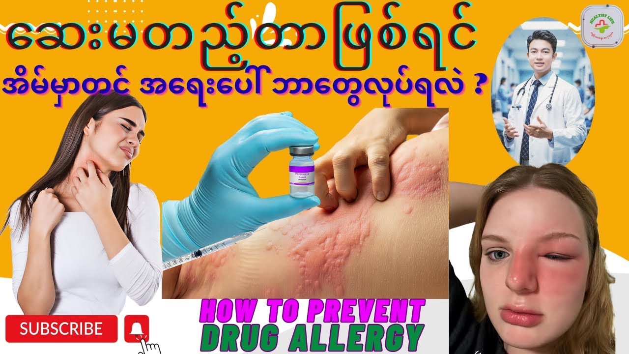 ဆေးမတည့်တာဖြစ်ရင် အိမ်မှာတင် အရေးပေါ် ဘာတွေလုပ်ရလဲ | What's Drug Allergy , How to Prevent it?