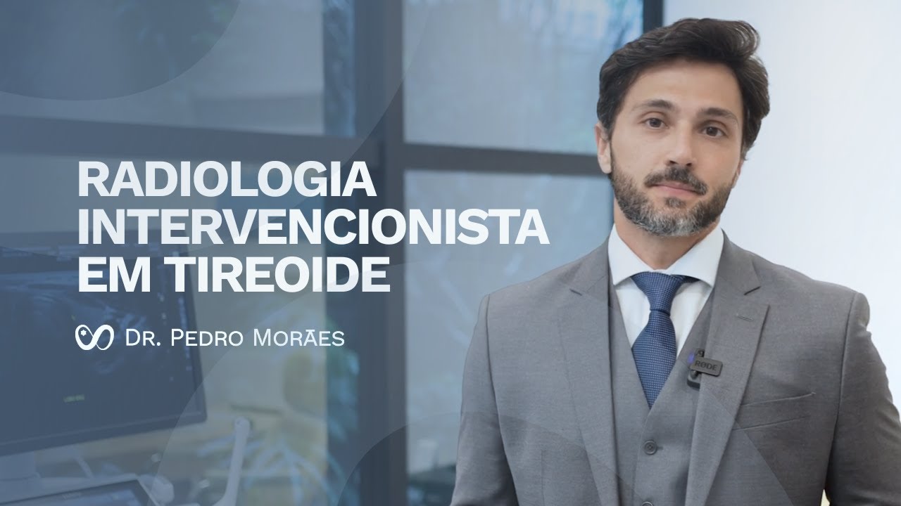 Radiologia Intervencionista: tratamento da tireoide sem cirurgia | Dr. Pedro Moraes