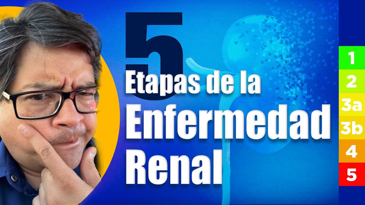 ✅ los estadios o las etapas de la Enfermedad Renal Cr&oacute;nica &iquest;Indican la gravedad de tu condici&oacute;n?👀