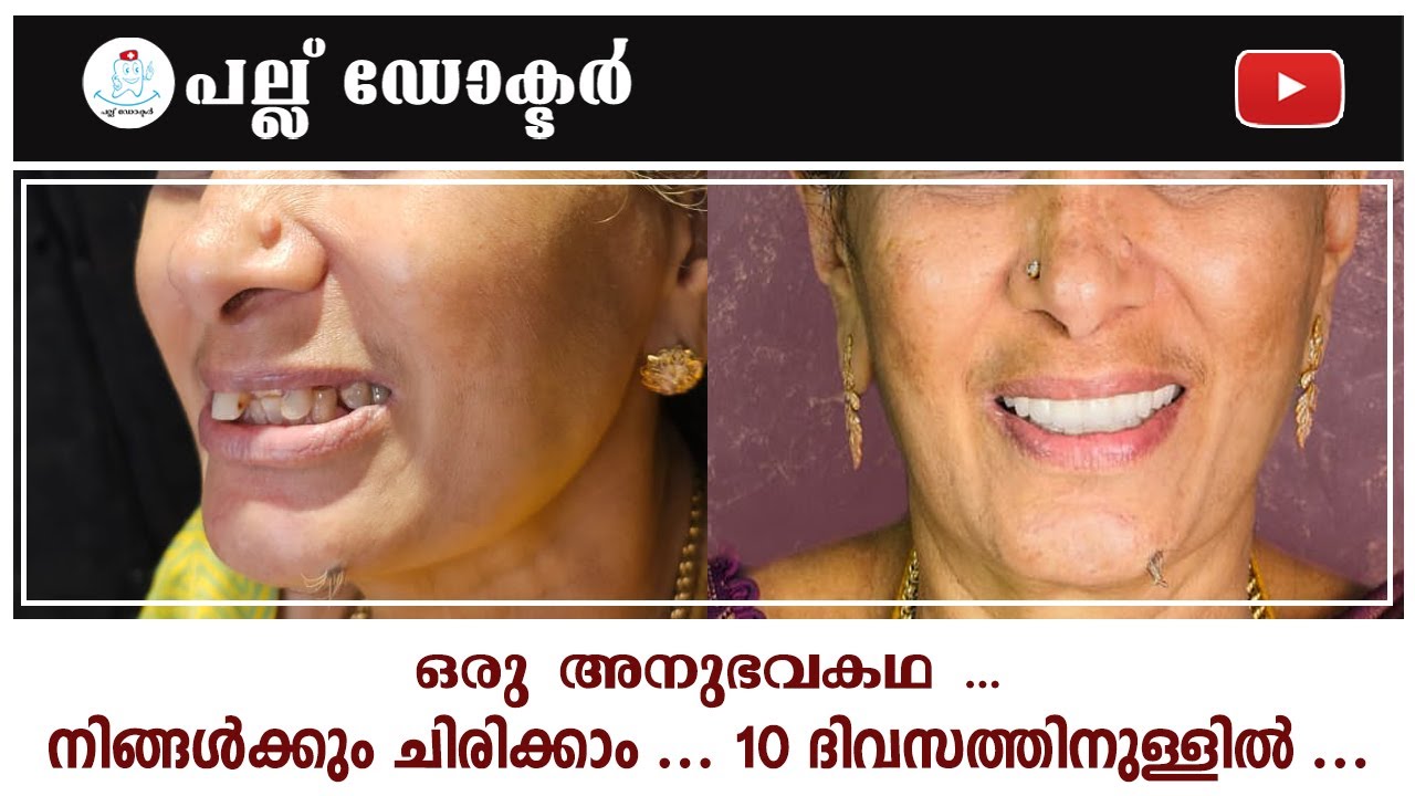 നിങ്ങൾക്കും ചിരിക്കാം ... 10 ദിവസത്തിനുള്ളിൽ ...
