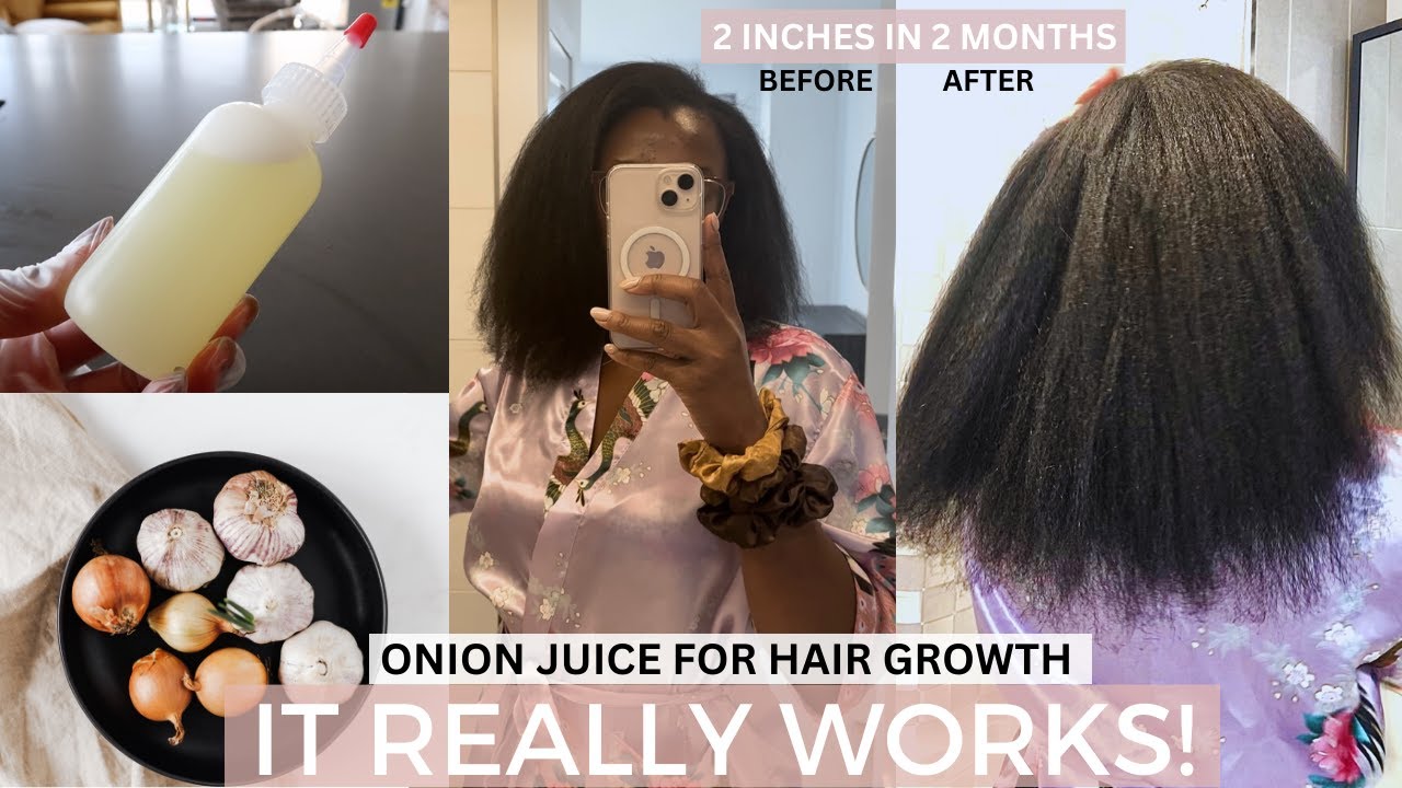Onion Juice for Hair Growth | How to grow longer Hair