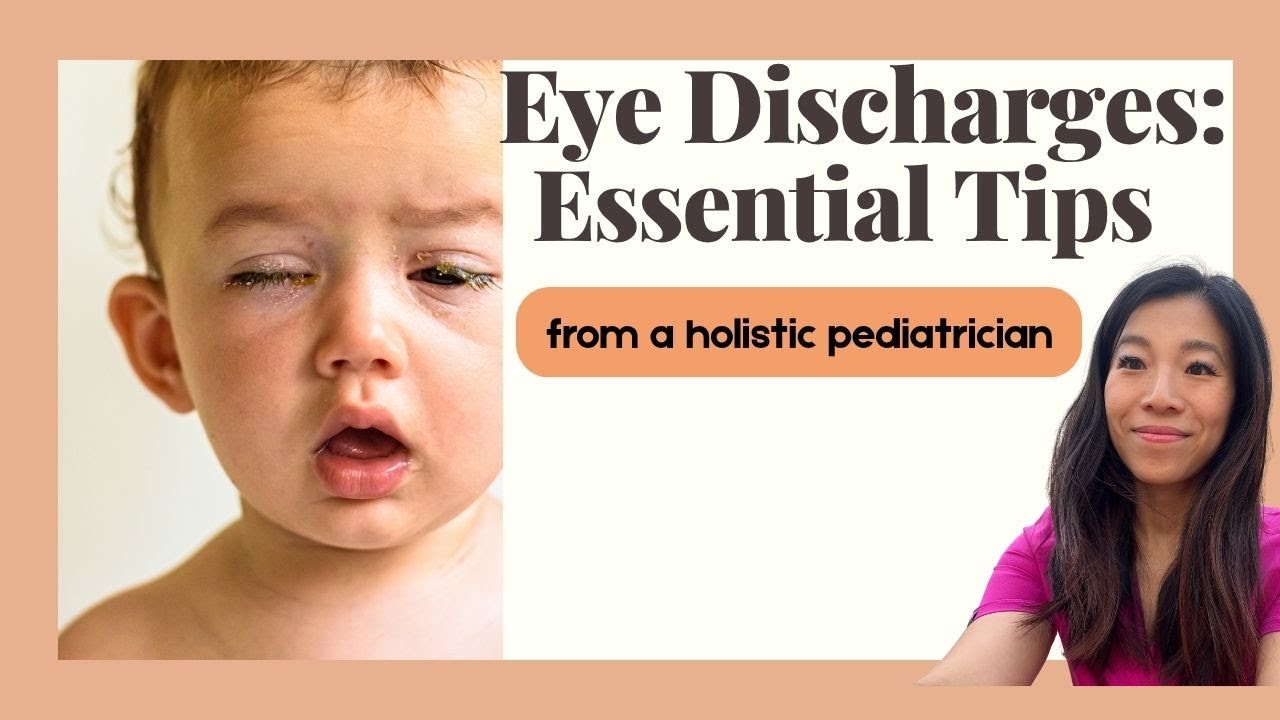 Eye Discharges in Babies and Kids: Essential Tips in Treating Goopy Eyes