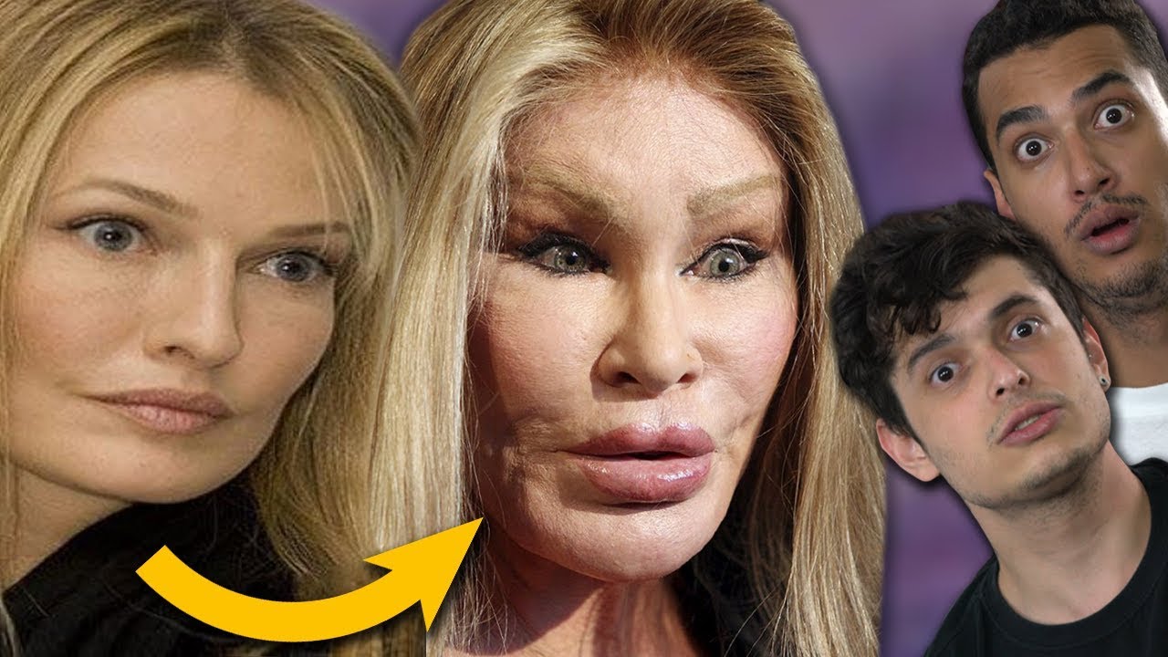 11 cirurgias PL&Aacute;STICAS que deram muito ERRADO