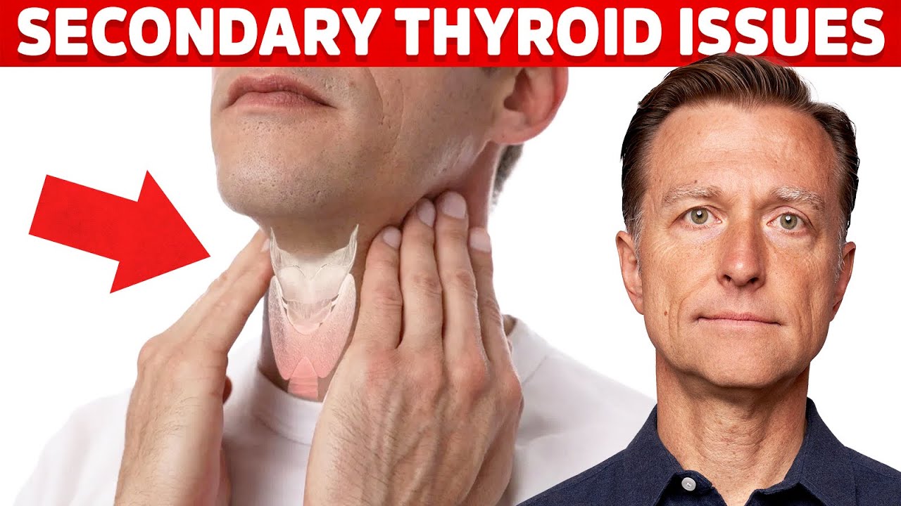 Most Thyroid Issues Are Secondary to Other Problems &ndash; Dr. Berg