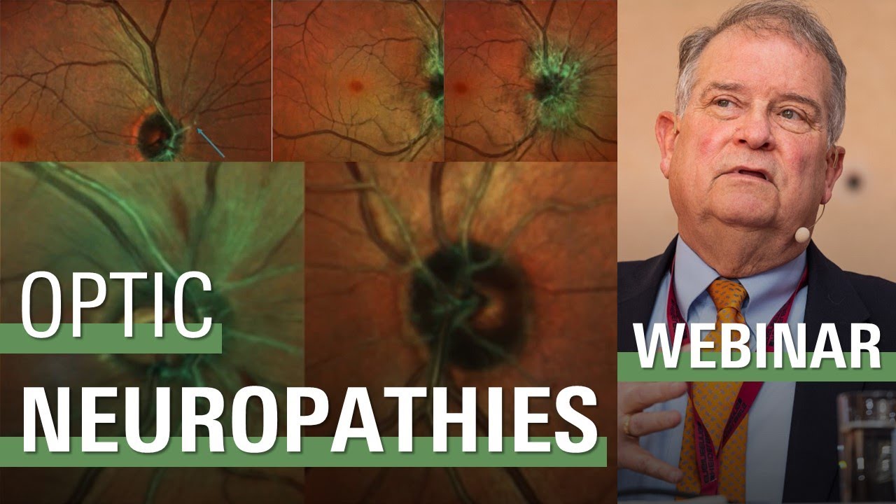 MultiColor Imaging for Assessment of Optic Neuropathies