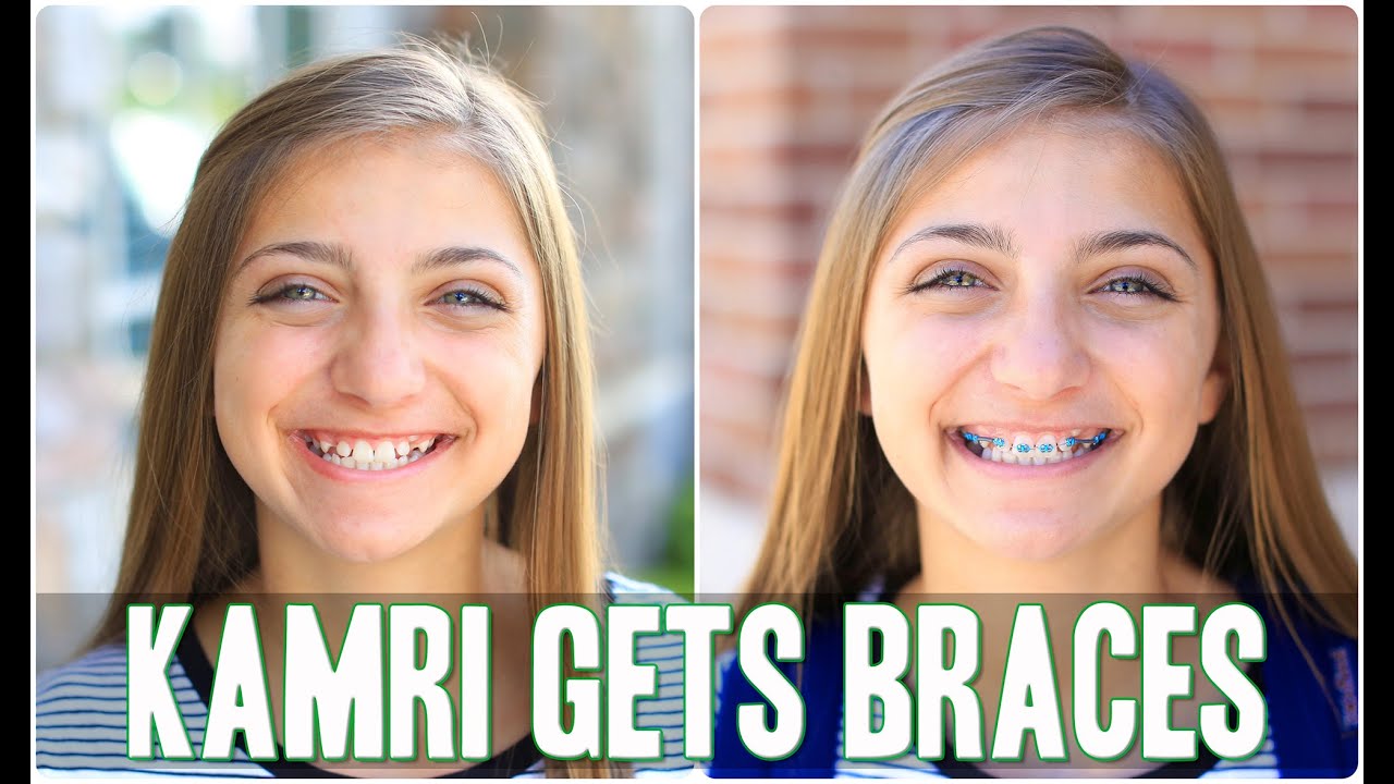 Kamri Gets Braces! | Behind the Braids Ep.4