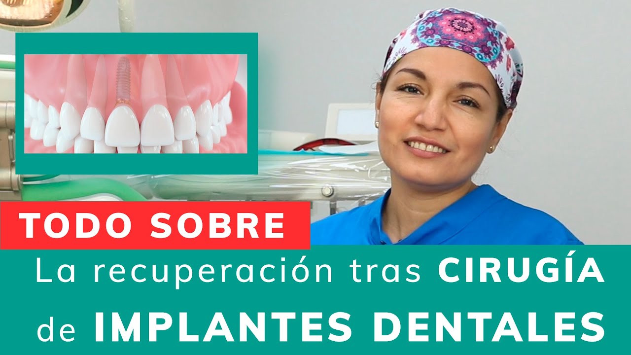 ¿Cómo debes cuidarte luego de una cirugía de IMPLANTE DENTAL?