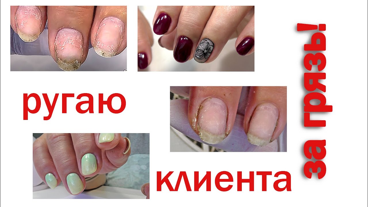 Треш маникюр с отслойками. Грязь под ногтями. Хроника, три работы