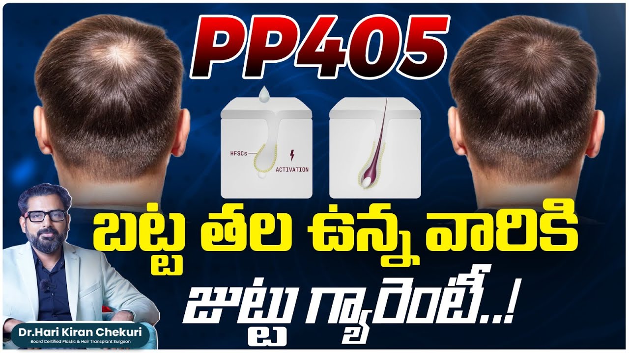 PP405 Explained | What It Is & How It Works || Best Hair Growth Technic || ReDefine Channel
