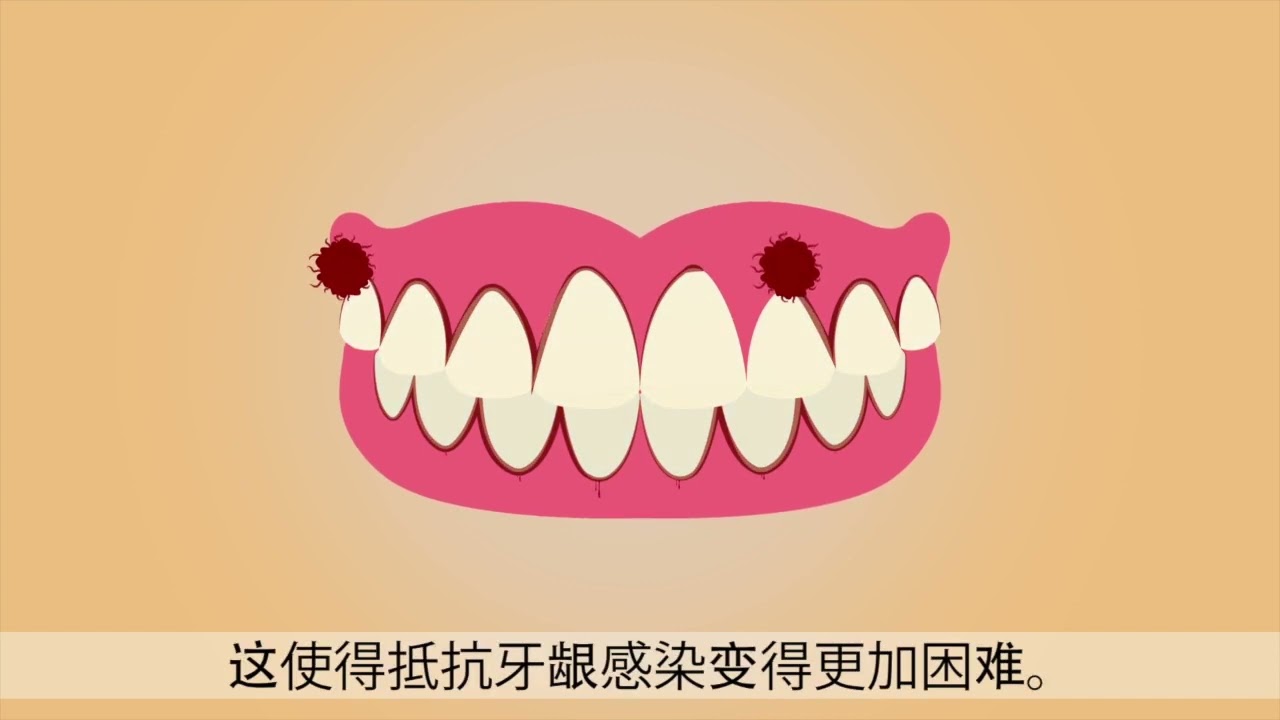 香烟的危害 (國語)