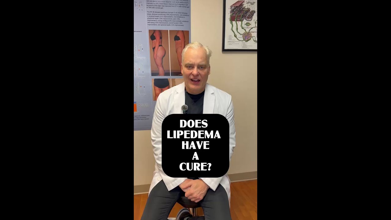 Lipedema Treatment Options: Surgery, Conservative Care & What Comes Next