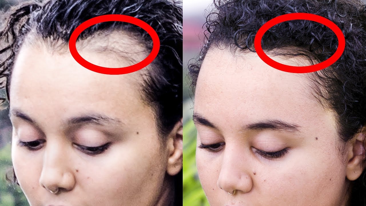 HOW I PREVENT HAIR LOSS: 18 Tips for Thicker Hair Pt.1