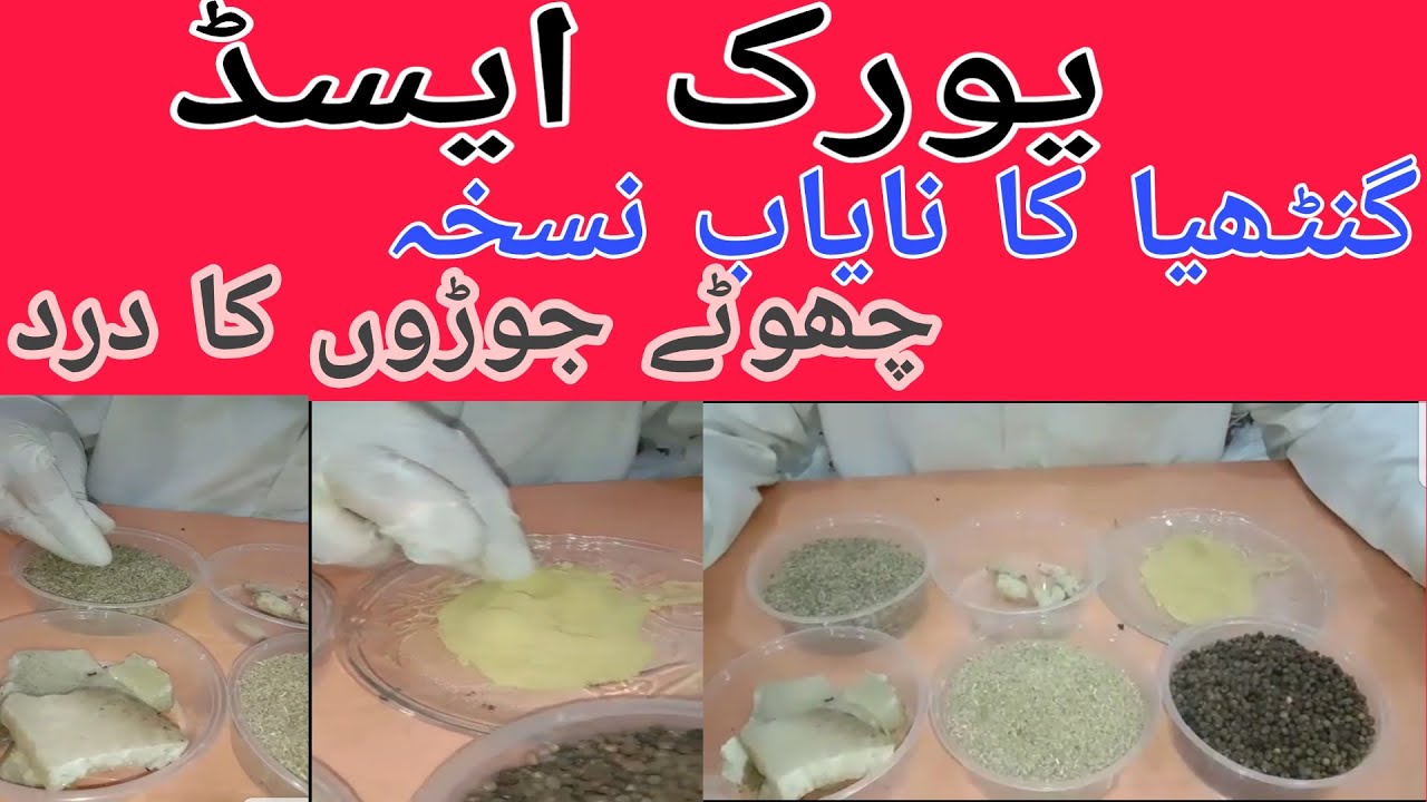 Uric Acid ka masla, chote joron ka dard, tango ke paniya ka dard aur Gathiya ka dard 03002241561