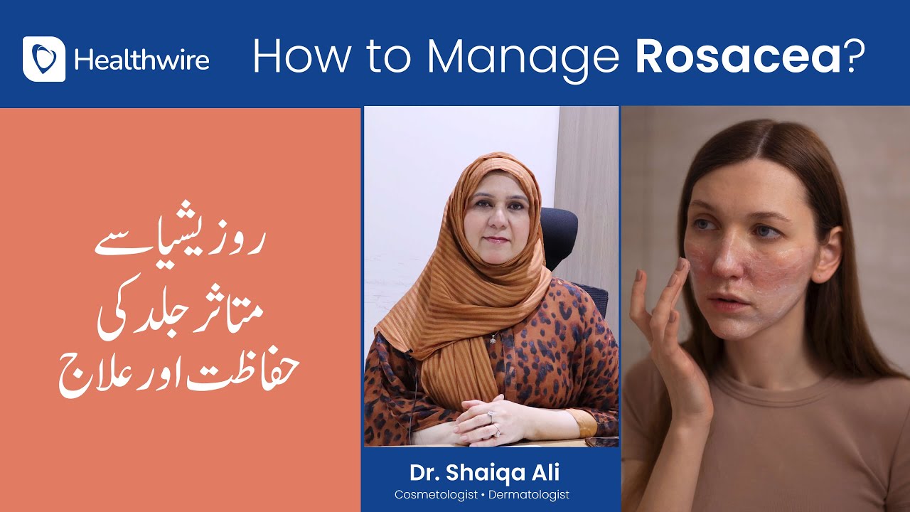 Rosacea Treatment in Urdu - A Dermatologist’s Guide to Rosacea Skin Care!