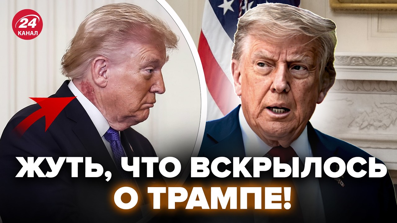 😮Вы НЕ ПОВЕРИТЕ, что с Трампом! Журналисты ЗАМЕТИЛИ ТАКОЕ, что все остолбенели.Это СКРЫВАЛИ ото всех