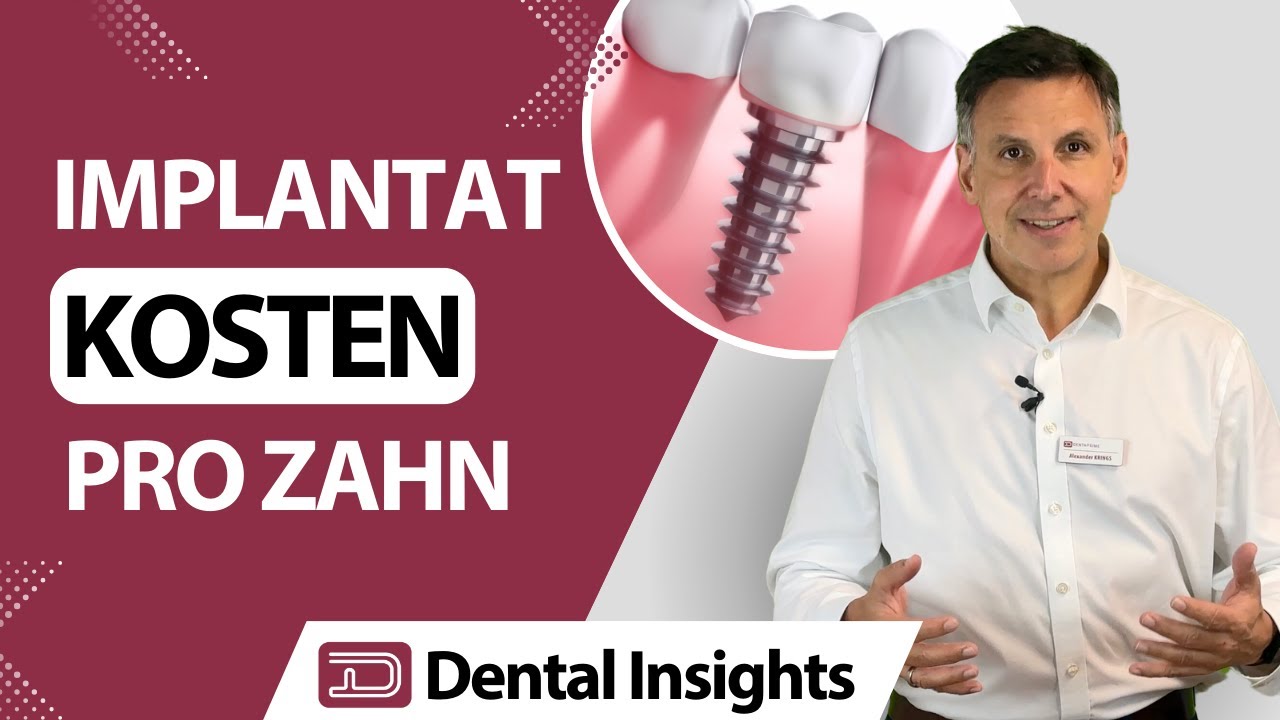 Zahnimplantat Kosten pro Zahn  | MIT BEISPIEL!