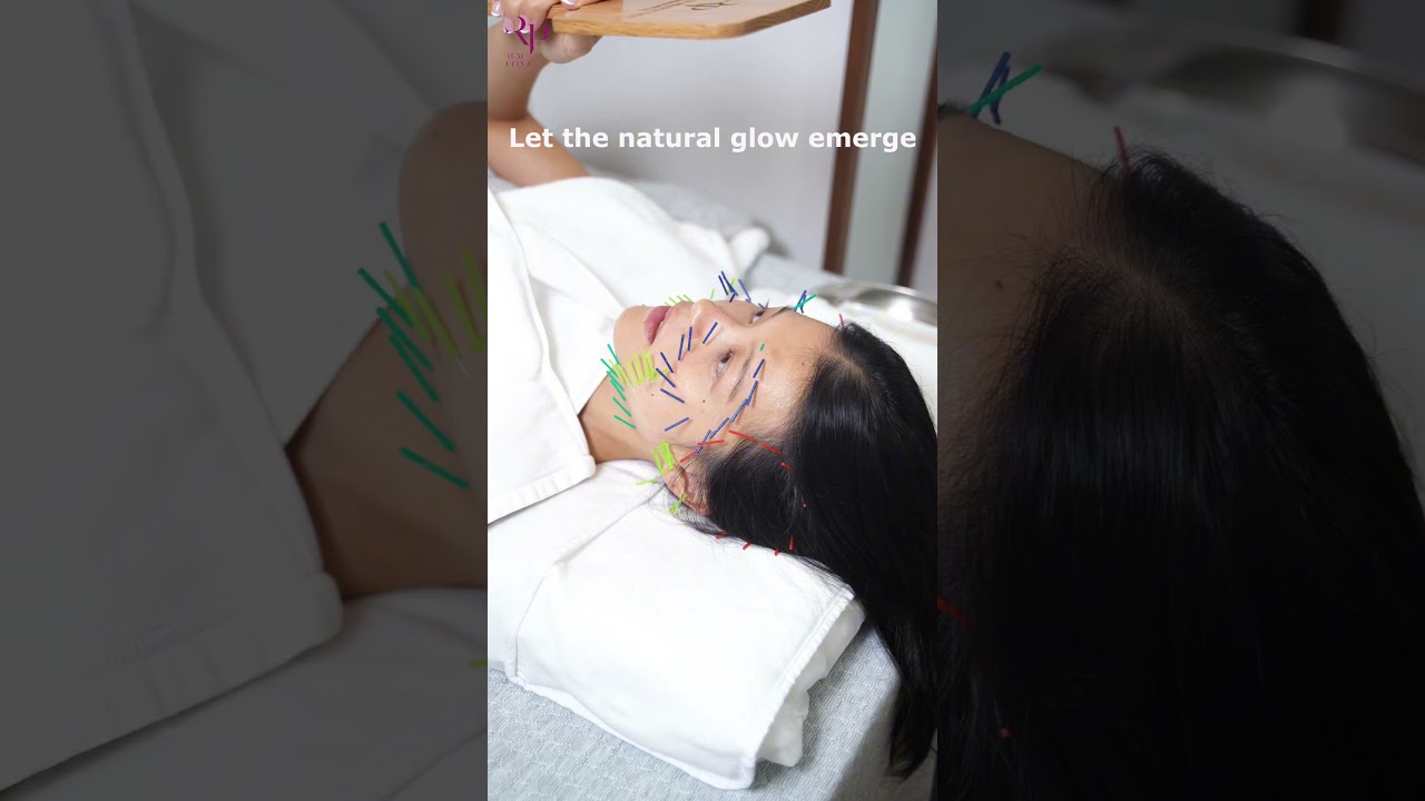 From start to finish — a Facial Acupuncture journey, precise, gentle, and deeply relaxing