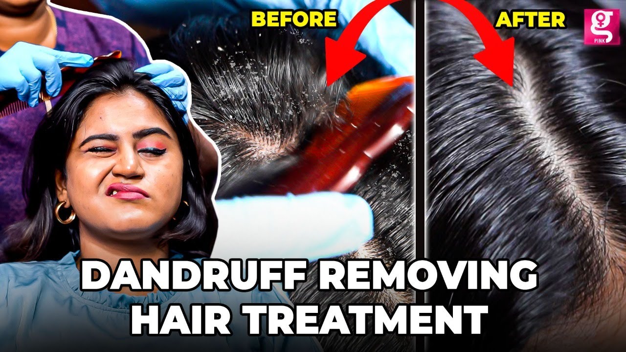 High Frequency Treatment for Dandruff |  Dandruff Treatment ASMR