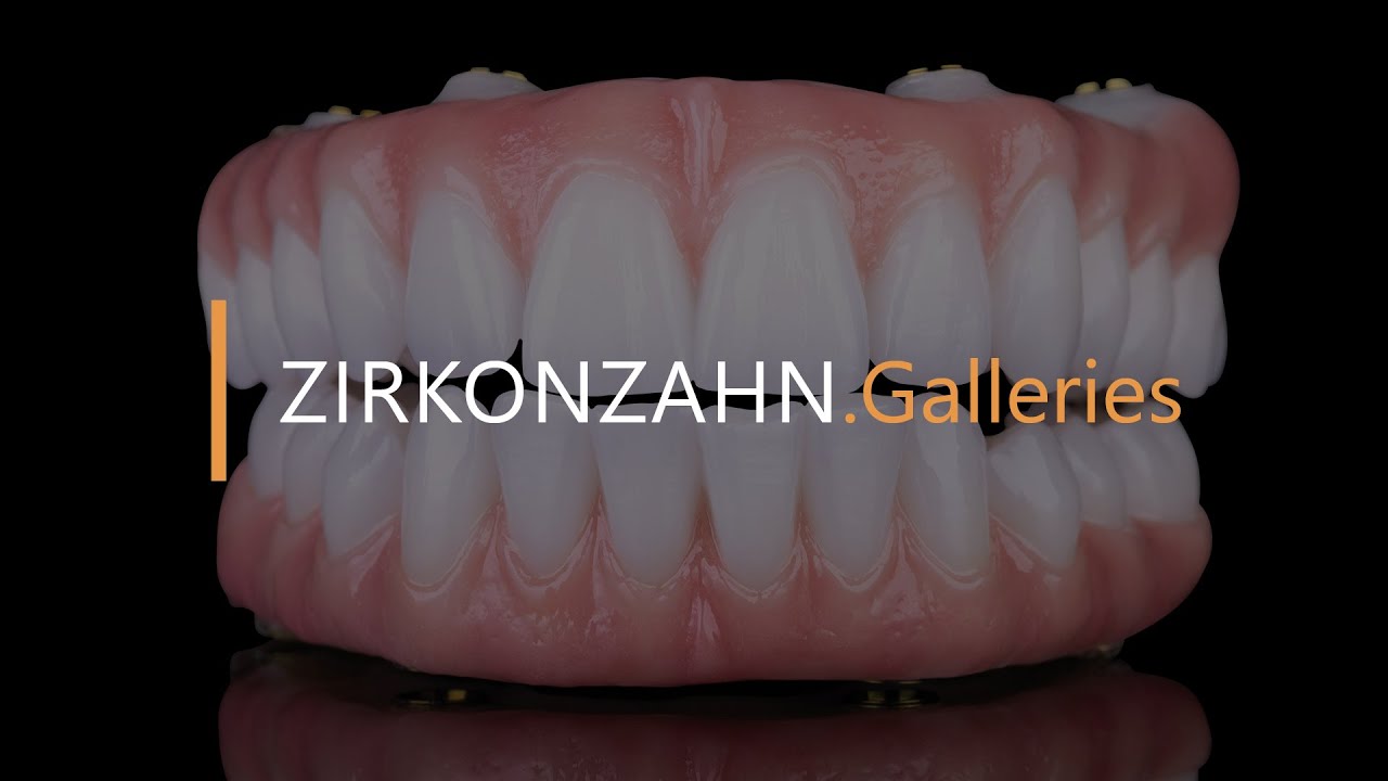 Prettau® 2 Dispersive® Bleach 0M1 & Fresco Ceramics | Zirkonzahn.Galleries