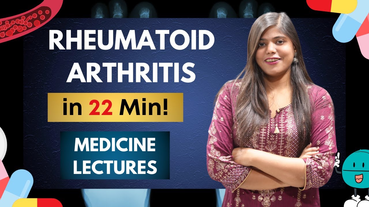 Rheumatoid arthritis - Diagnostic criteria, complications, treatment | Medicine notes and lectures